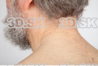 Neck texture of Roger 0007